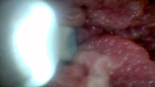 Can You See the Most Sensitive Penis Spots Here?